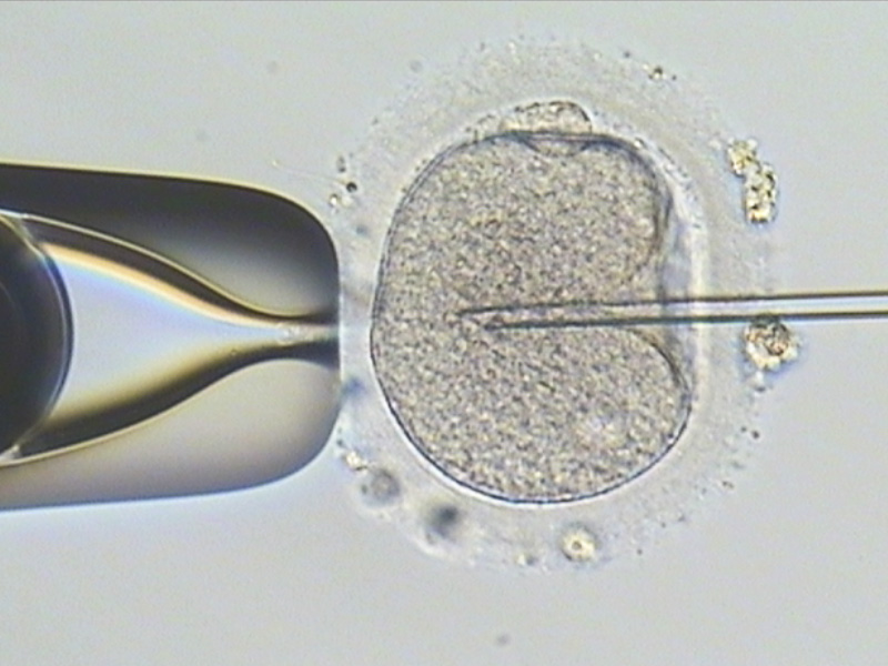 單一精蟲顯微授精術-安安試管嬰兒中心,不孕症,試管嬰兒,人工受孕,冷凍卵子