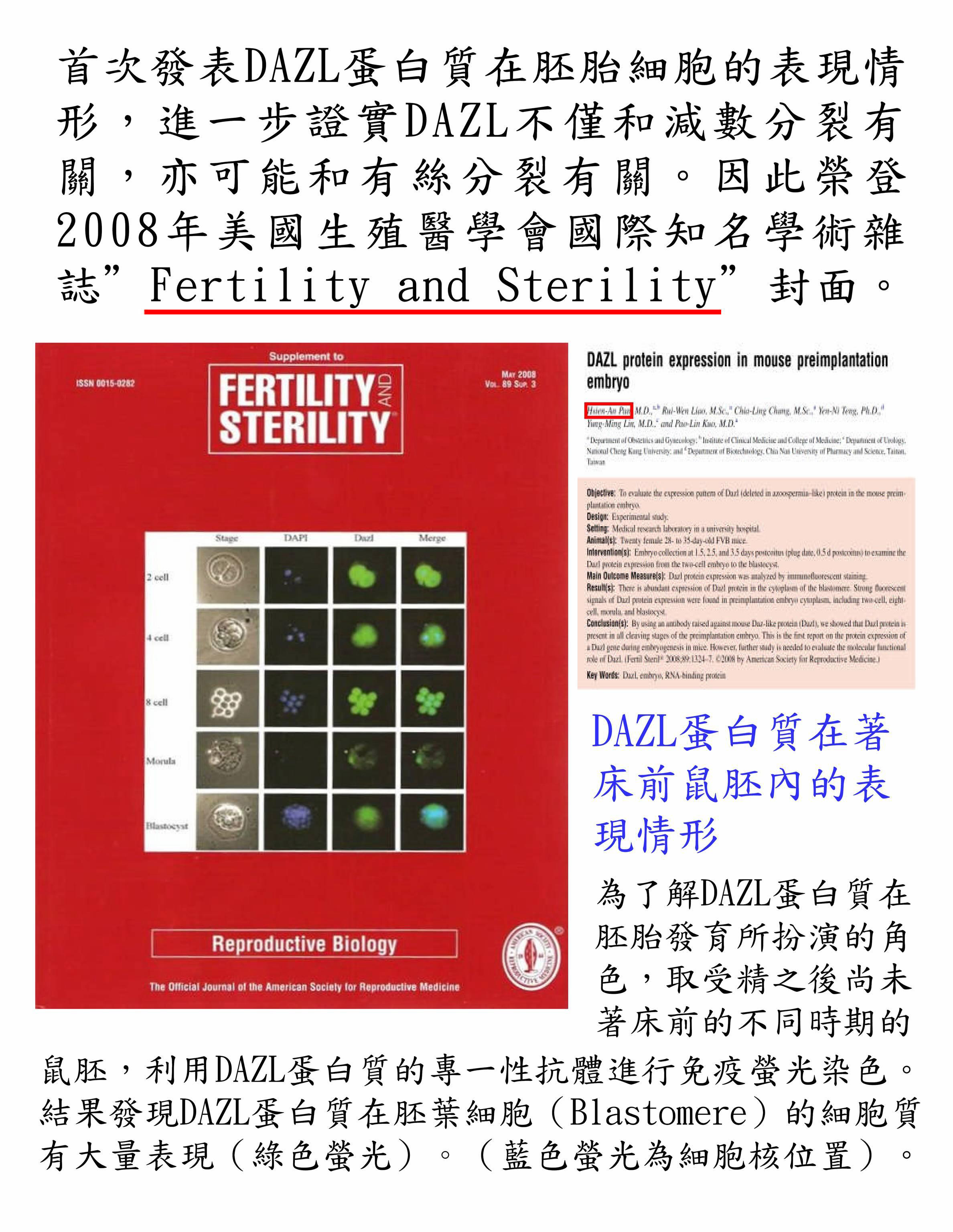 榮登2008年美國生殖醫學會際知名學術雜誌「Fertility and Sterility」封面--安安試管嬰兒中心