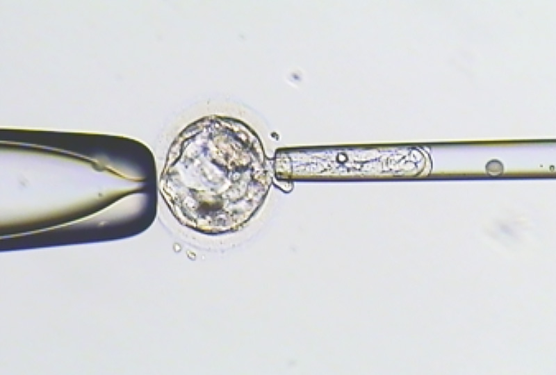 胚胎著床前染色體篩檢