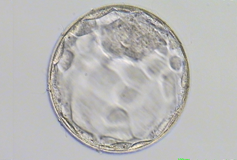  囊胚期胚胎培養
